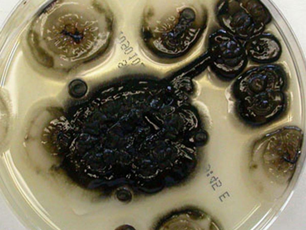 Aureobasidium pullulans — Black Yeast