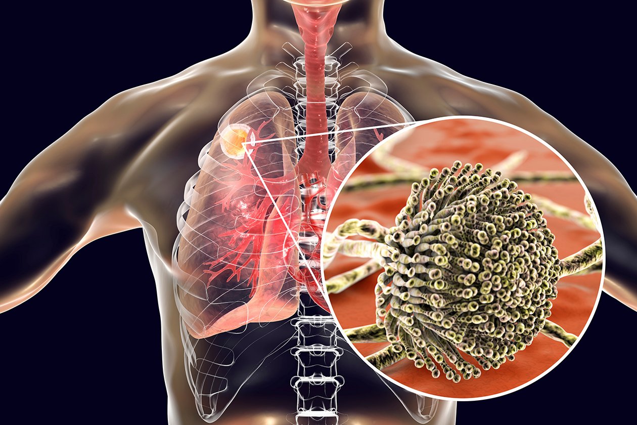 health effects caused by mold on individuals