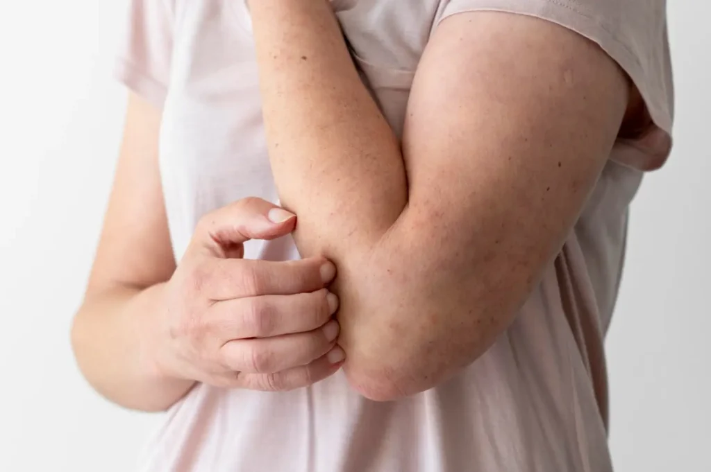 skin allergy triggered due to mold
